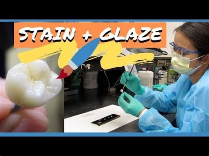 Can you paint a tooth crown?