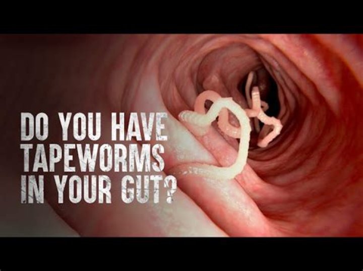 Can you pull tapeworm out of your mouth?