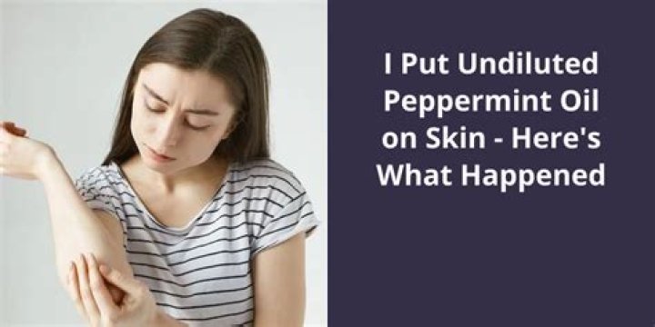 Can you put peppermint oil on your skin?