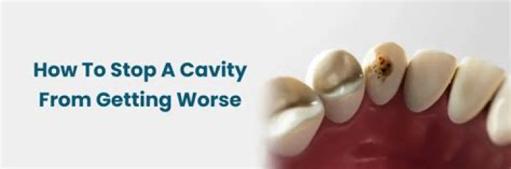 Can you stop a cavity from getting worse?