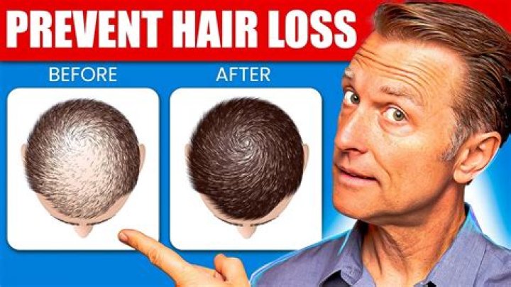 Can you stop hair loss?