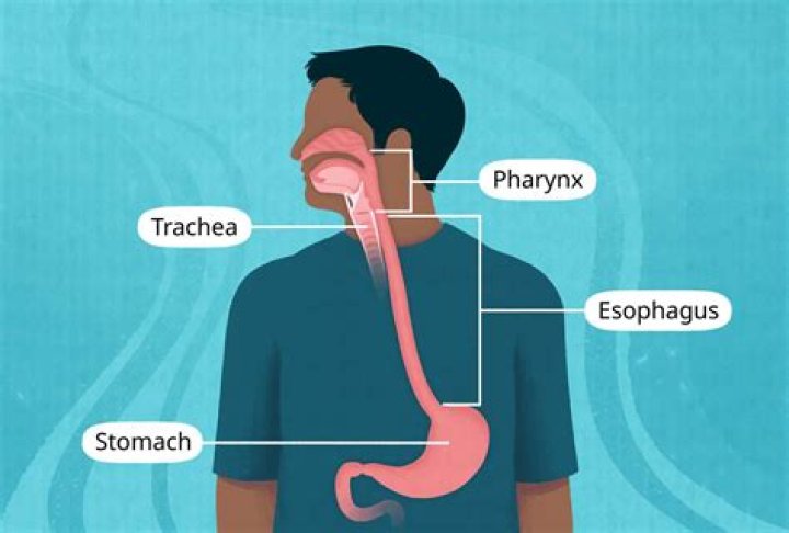 Can you strain your esophagus?
