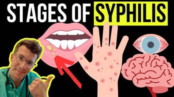 Can you test negative for syphilis and still have it?