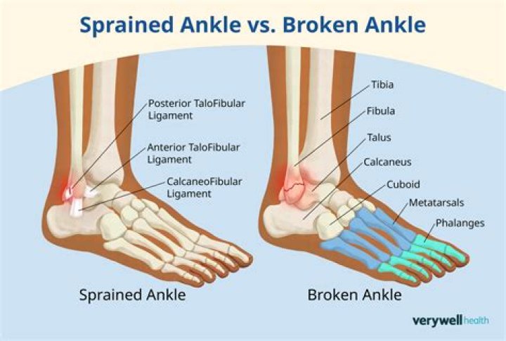 Can you wiggle your toes if you break your ankle?