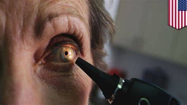Can your eyes burn?