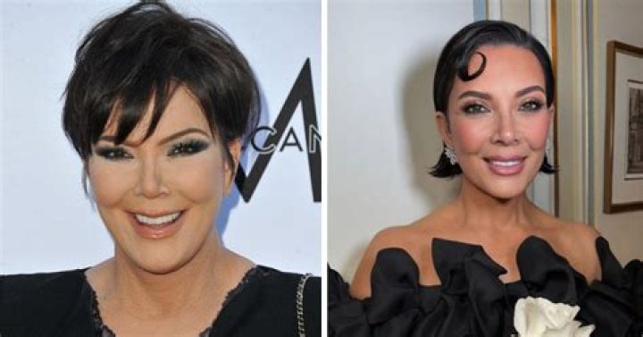 Did Angela have a facelift?