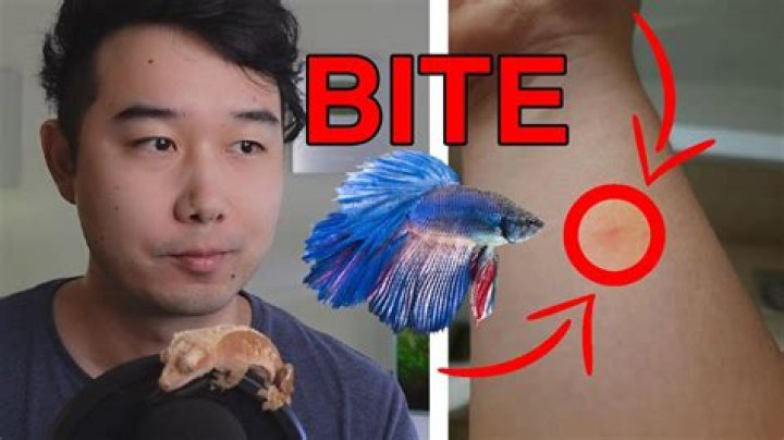 Do betta fish bites hurt?