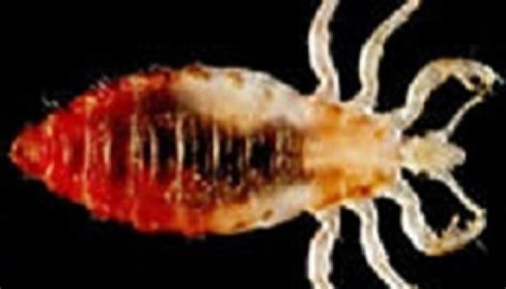 Do body lice jump?