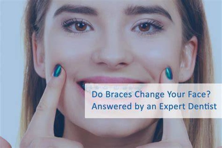 Do braces affect taste?