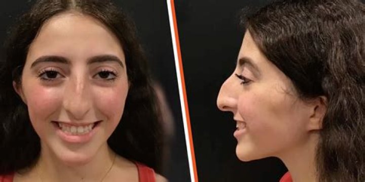 Do breasts feel different before period?
