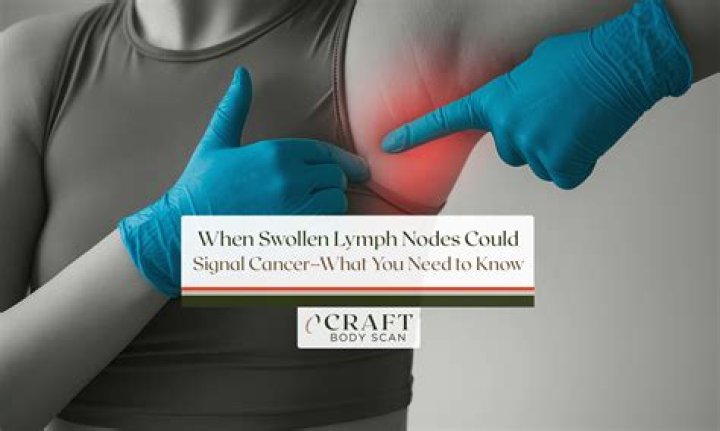 Do cancerous lymph nodes get bigger?