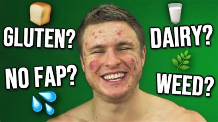 Do hot showers make acne worse?