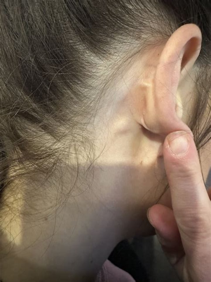 Do I have a tumor behind my ear?