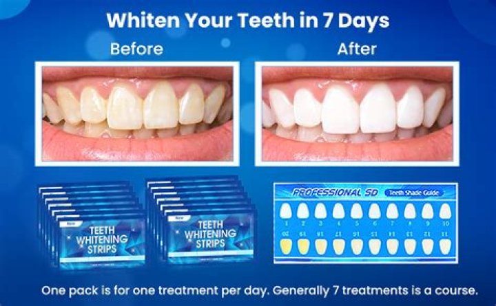 Do I need to brush my teeth after using whitening strips?
