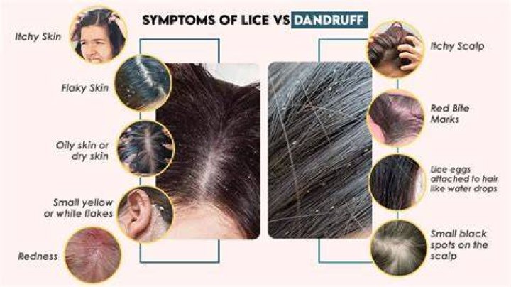 Do lice like African hair?