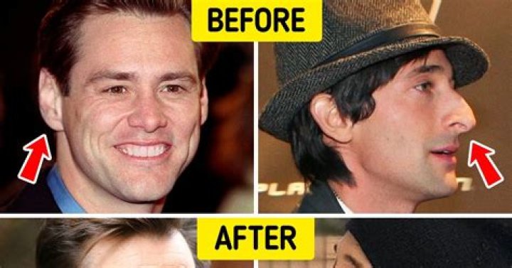 Do noses get bigger with age?