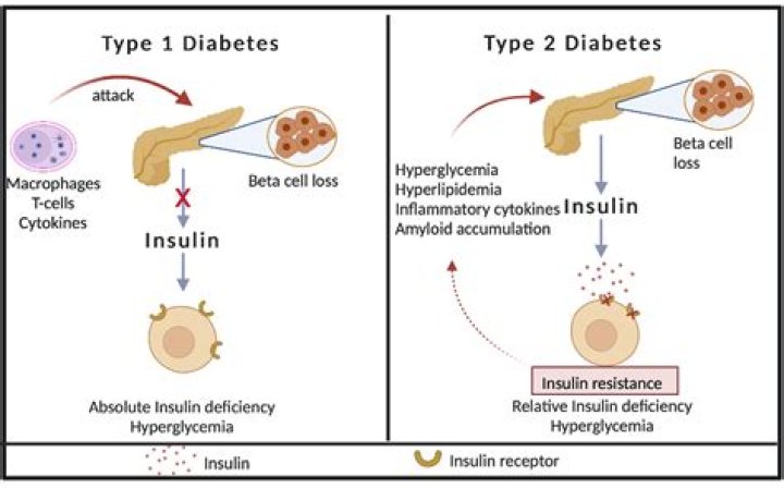 Do type 1 diabetics still need their pancreas?
