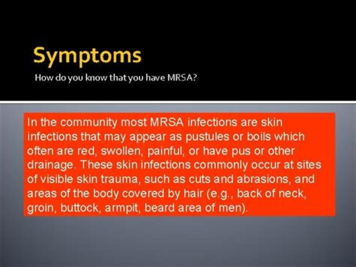 Do you always have MRSA?