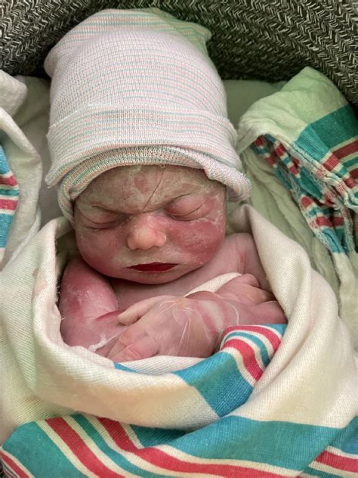 Do you have to bury a stillborn baby?