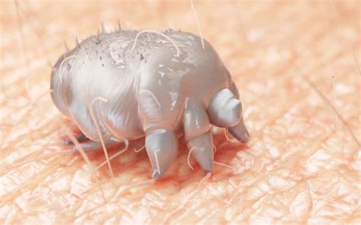Do you need an exterminator for scabies?