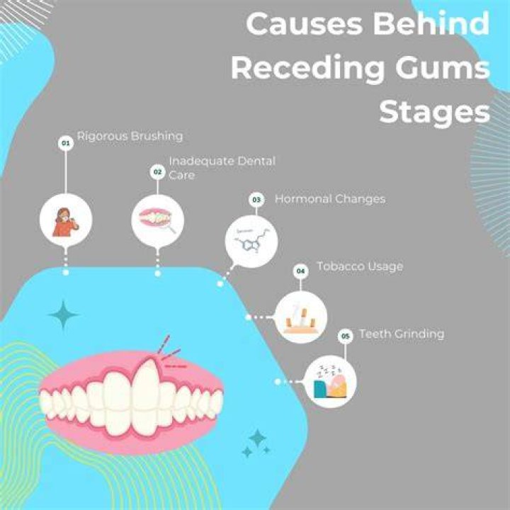 Do you need surgery for receding gums?