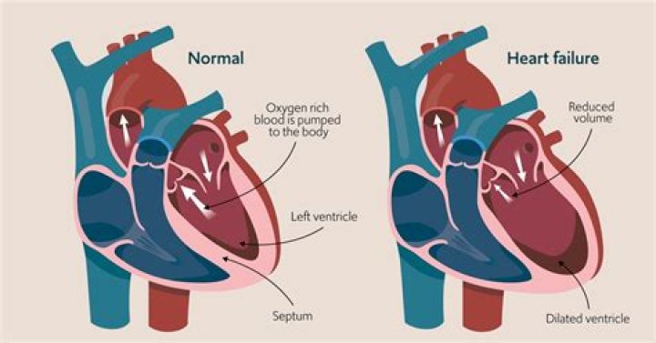 Do you sleep a lot with congestive heart failure?