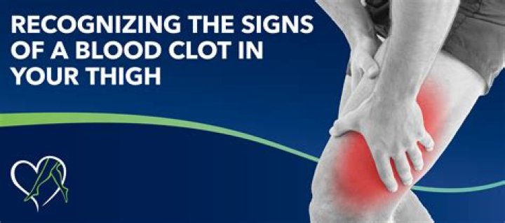 Does a blood clot in the leg hurt constantly?