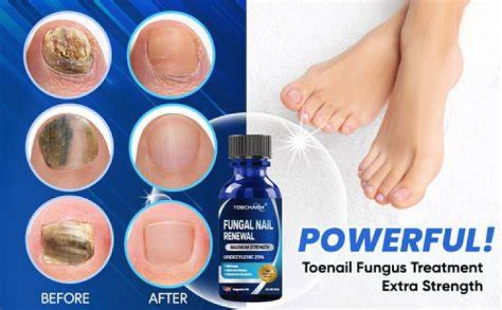 Does a podiatrist treat toenail fungus?