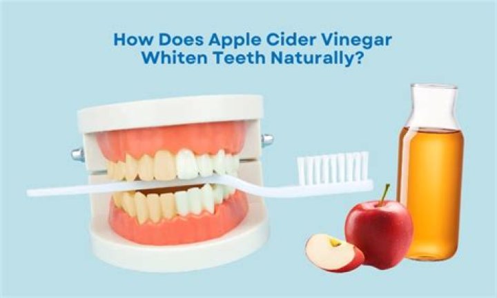 Does apple cider vinegar whiten teeth?