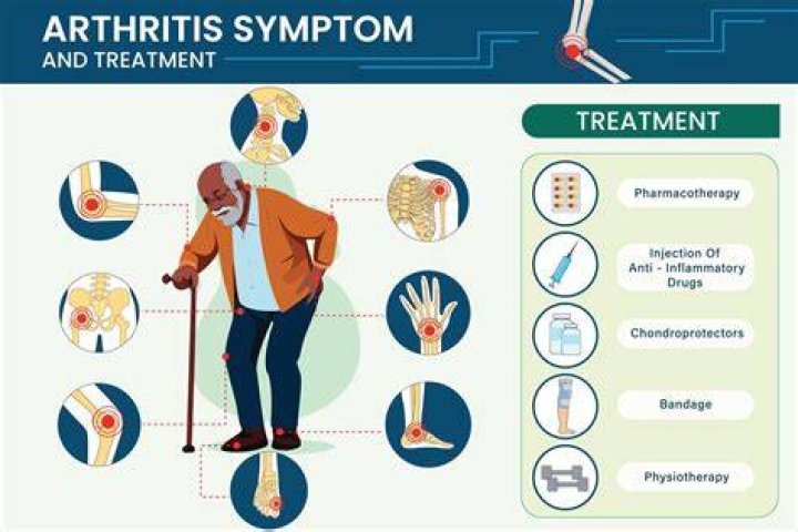 Does arthritis cause nerve pain?
