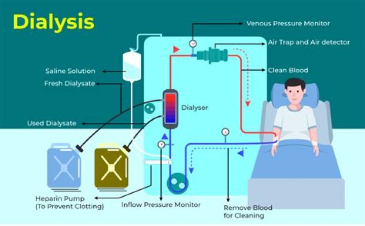 Does dialysis remove fluid from lungs?