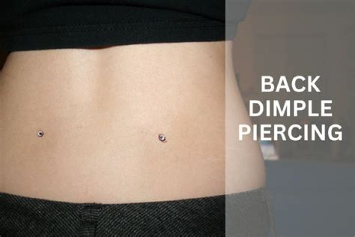 Does dimple come back?
