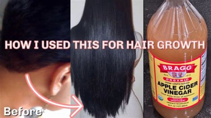 Does drinking apple cider vinegar help hair growth?
