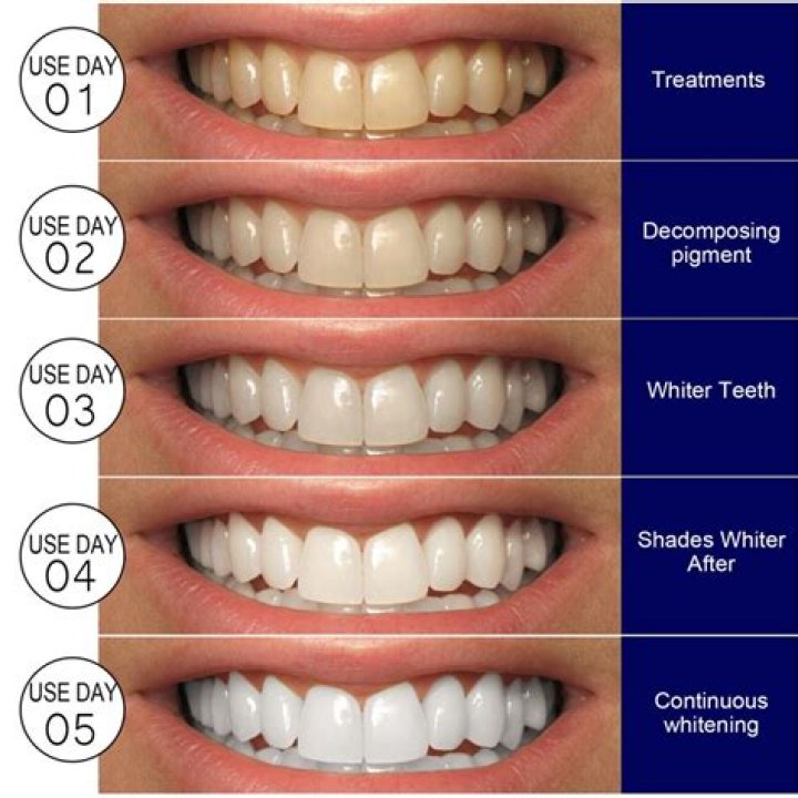 Does drinking milk whiten teeth?