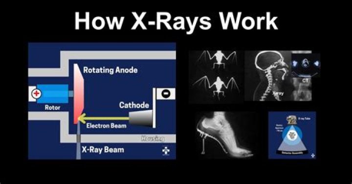 Does EDS show on xrays?