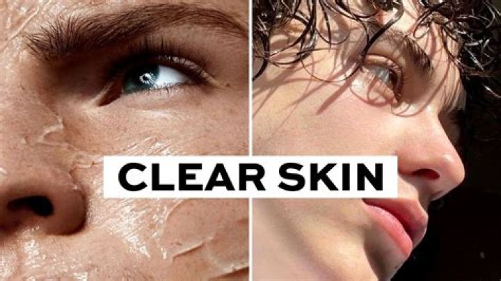 Does exercising help clear skin?