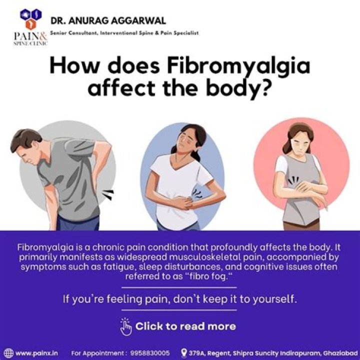 Does fibromyalgia affect bowels?