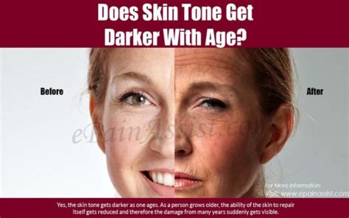Does gold get darker with age?