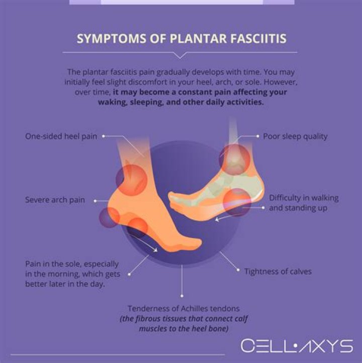 Does heat make plantar fasciitis worse?