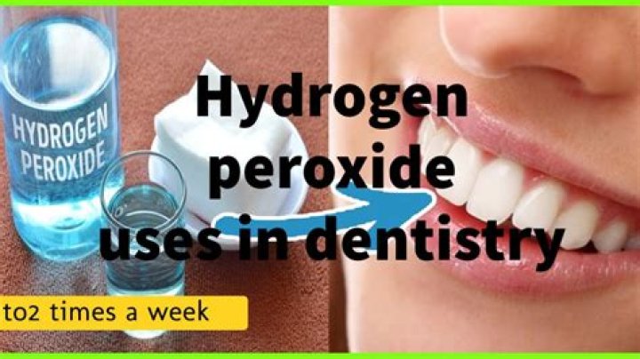 Does hydrogen peroxide dissolve plaque?