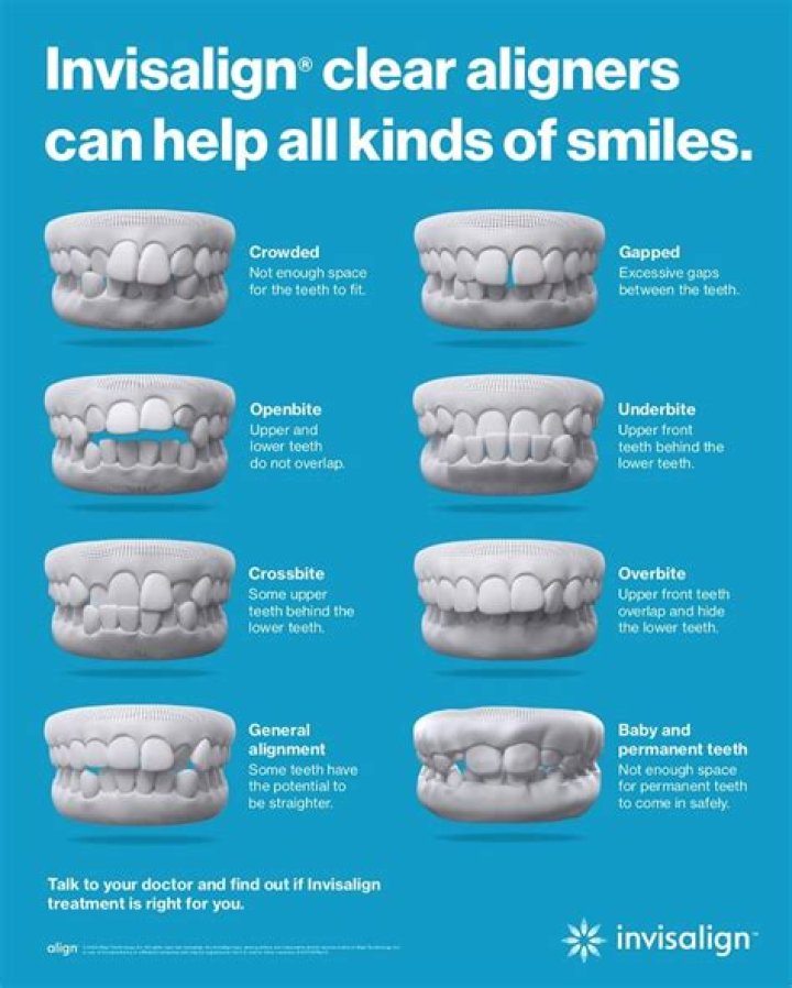 Does it hurt to get Invisalign attachments off?