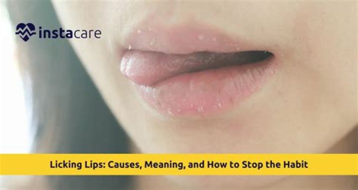 Does licking your lips make it worse?