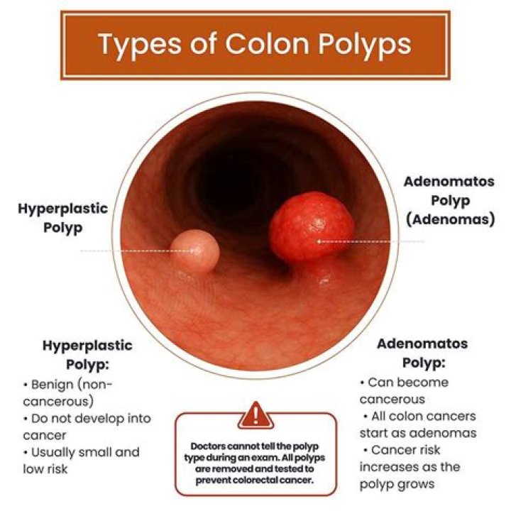 Does Metamucil prevent colon polyps?