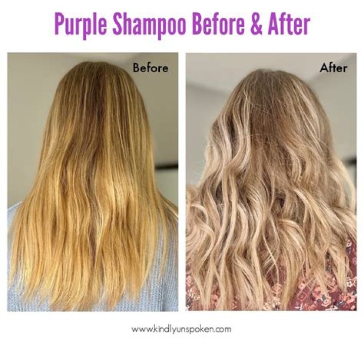 Does purple shampoo get rid of brassy tones?