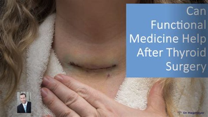 Does removing your thyroid shorten your life?