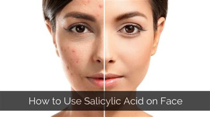 Does salicylic acid bring pimples to surface?