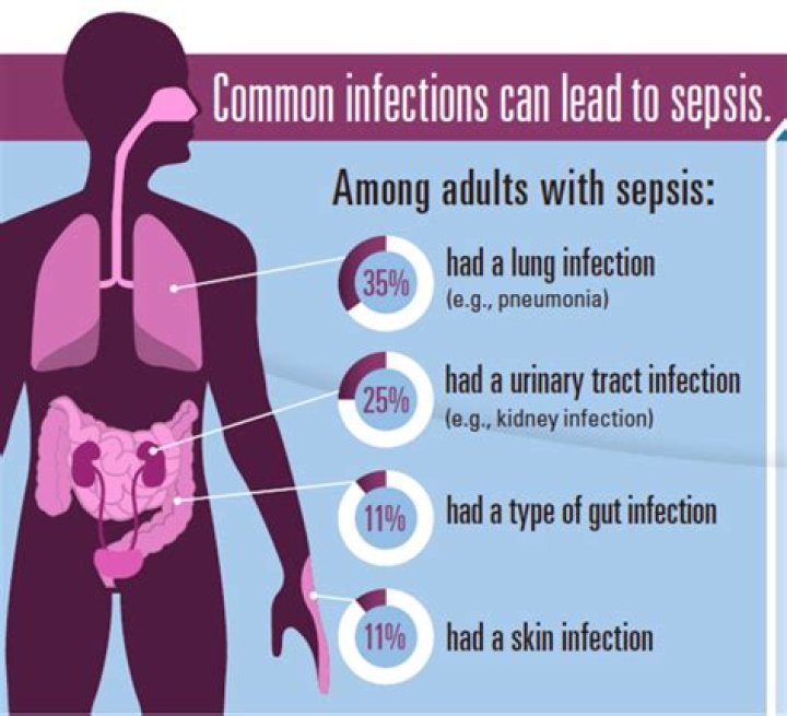 Does sepsis always have a fever?