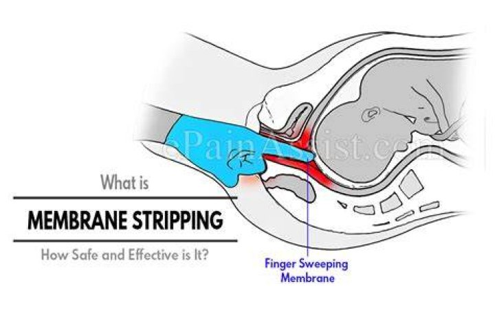 Does stripping your membranes hurt?