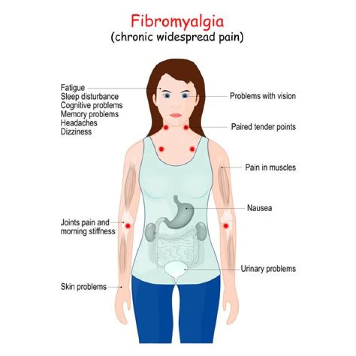 Does the sun affect fibromyalgia?