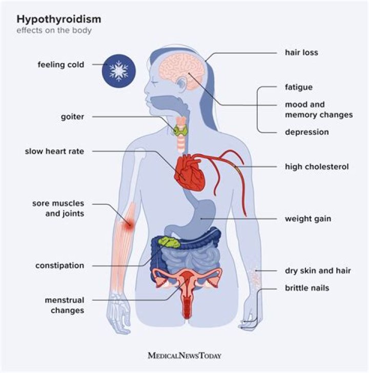 Does thyroid affect your stomach?